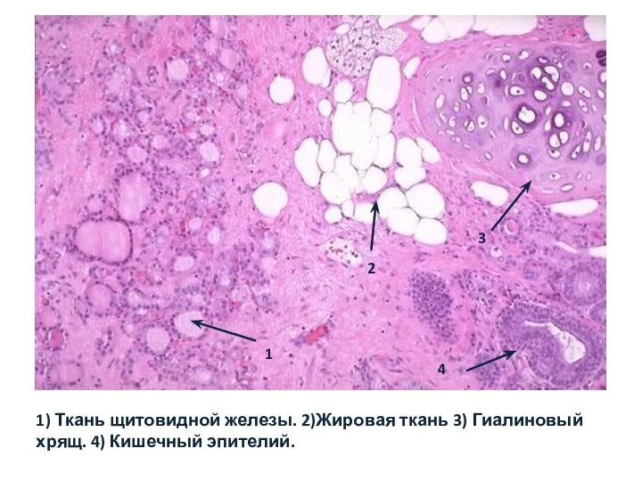 1 2 3 4 1) Ткань щитовидной железы. 2)Жировая ткань 3) Гиалиновый хрящ. 4) Кишечный эпителий.