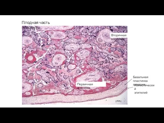 Амниотический эпителий Базальная пластинка амниона Плодная часть плаценты. Вторичная ворсинка Первичная ворсинка