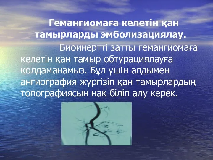 Гемангиомаға келетін қан тамырларды эмболизациялау. Биоинертті затты гемангиомаға келетін қан тамыр обтурациялауға