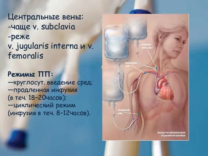 Центральные вены: -чаще v. subclavia -реже v. jugularis interna и v. femoralis