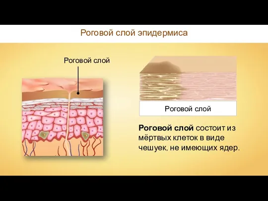 Роговой слой эпидермиса Роговой слой Роговой слой состоит из мёртвых клеток в