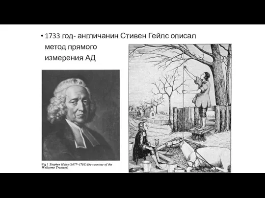 1733 год- англичанин Стивен Гейлс описал метод прямого измерения АД