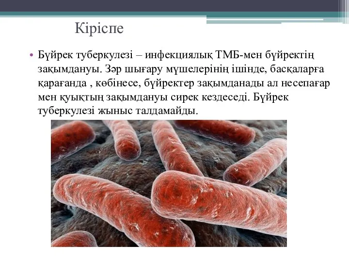 Кіріспе Бүйрек туберкулезі – инфекциялық ТМБ-мен бүйректің зақымдануы. Зәр шығару мүшелерінің ішінде,