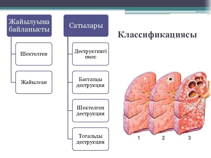 Классификациясы