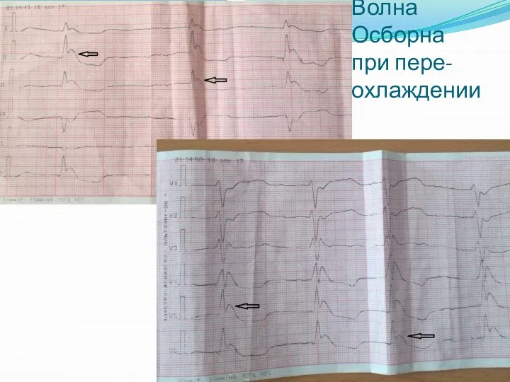 Волна Осборна при пере-охлаждении