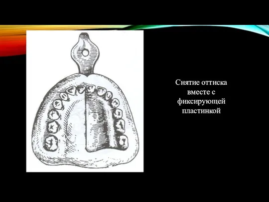 Снятие оттиска вместе с фиксирующей пластинкой