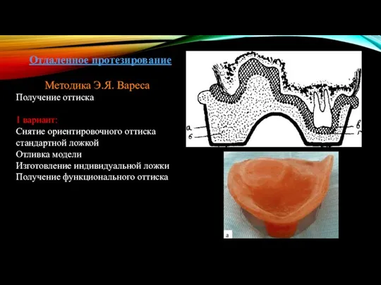 Отдаленное протезирование Методика Э.Я. Вареса Получение оттиска 1 вариант: Снятие ориентировочного оттиска