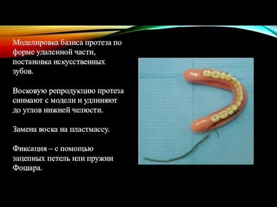 Моделировка базиса протеза по форме удаленной части, постановка искусственных зубов. Восковую репродукцию