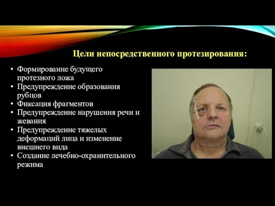 Цели непосредственного протезирования: Формирование будущего протезного ложа Предупреждение образования рубцов Фиксация фрагментов