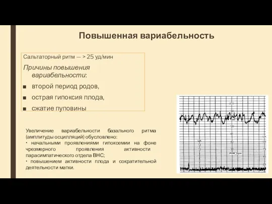 Повышенная вариабельность Сальтаторный ритм — > 25 уд/мин Причины повышения вариабельности: второй