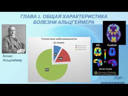 ГЛАВА 1. ОБЩАЯ ХАРАКТЕРИСТИКА БОЛЕЗНИ АЛЬЦГЕЙМЕРА Алоис Альцгеймер ПЭТ – сканирование