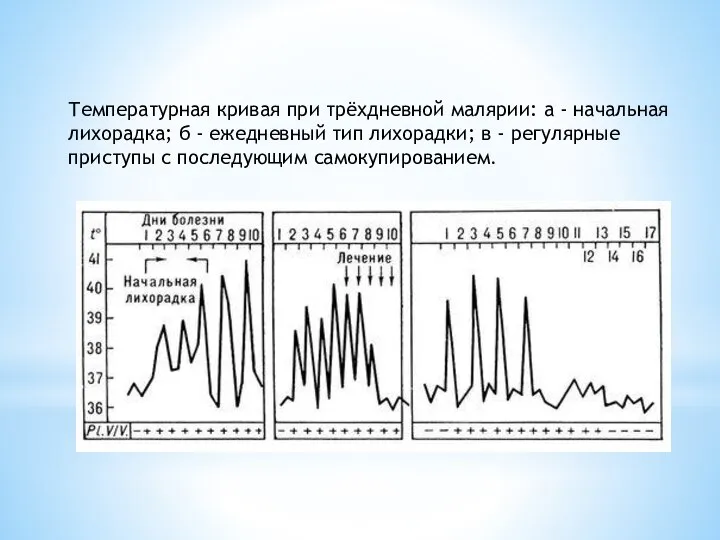 Температурная кривая при трёхдневной малярии: а - начальная лихорадка; б - ежедневный