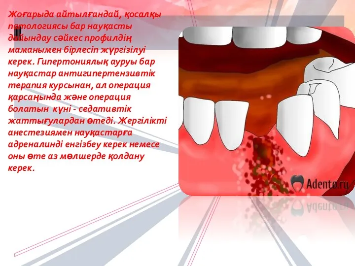 Жоғарыда айтылғандай, қосалқы патологиясы бар науқасты дайындау сәйкес профилдің маманымен бірлесіп жүргізілуі