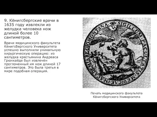 9. Кёнигсбергские врачи в 1635 году извлекли из желудка человека нож длиной