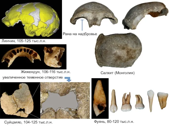 Жижендун, 106-116 тыс.л.н. Фуянь, 80-120 тыс.л.н. Салхит (Монголия) Рана на надбровье Суйцзияо,