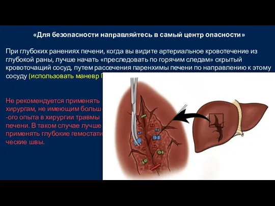 «Для безопасности направляйтесь в самый центр опасности» При глубоких ранениях печени, когда