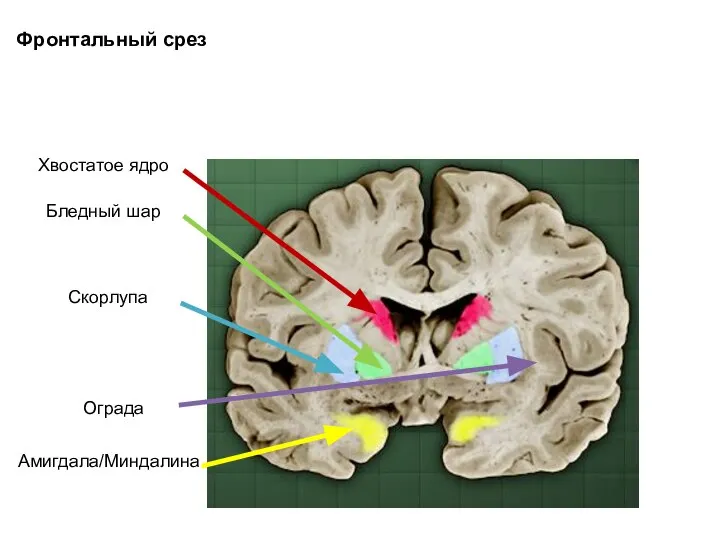 Хвостатое ядро Бледный шар Скорлупа Амигдала/Миндалина Ограда Фронтальный срез