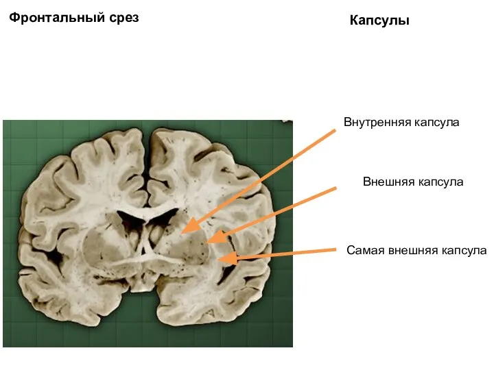 Фронтальный срез Капсулы Внутренняя капсула Внешняя капсула Самая внешняя капсула