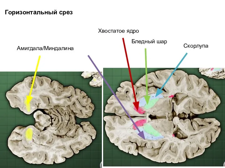 Хвостатое ядро Бледный шар Скорлупа Амигдала/Миндалина Горизонтальный срез