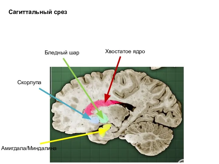 Хвостатое ядро Бледный шар Скорлупа Амигдала/Миндалина Сагиттальный срез