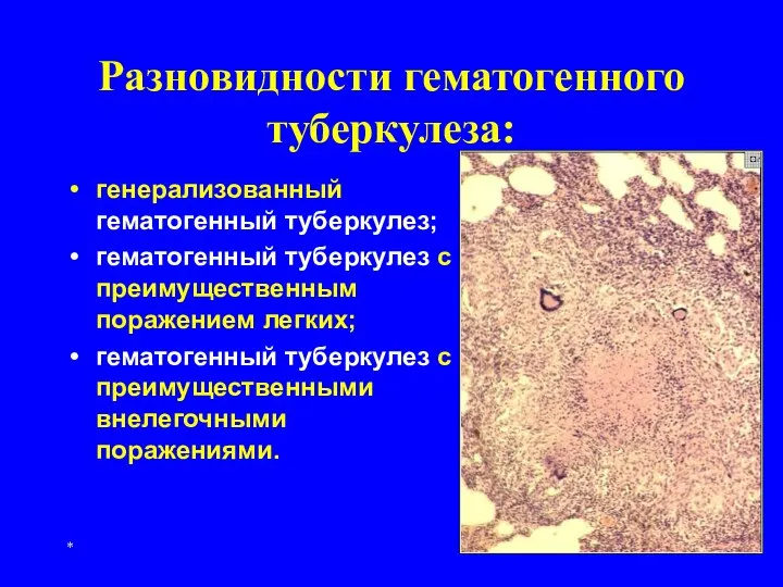 * Разновидности гематогенного туберкулеза: генерализованный гематогенный туберкулез; гематогенный туберкулез с преимущественным поражением