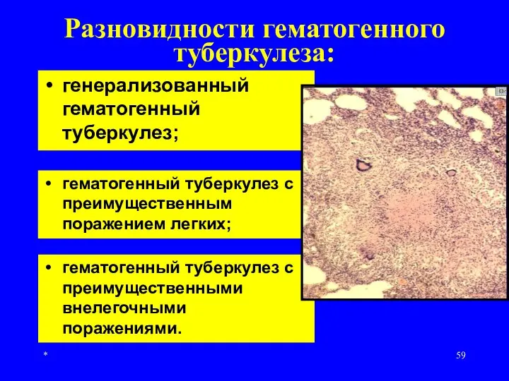 * Разновидности гематогенного туберкулеза: генерализованный гематогенный туберкулез; гематогенный туберкулез с преимущественным поражением