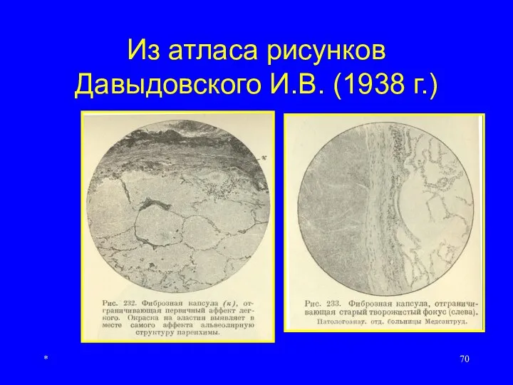 * Из атласа рисунков Давыдовского И.В. (1938 г.)