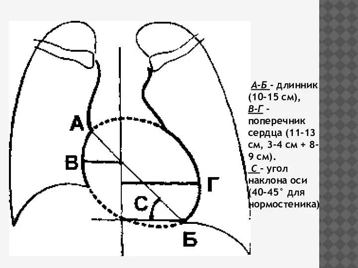 А-Б - длинник (10-15 см), В-Г - поперечник сердца (11-13 см, 3-4