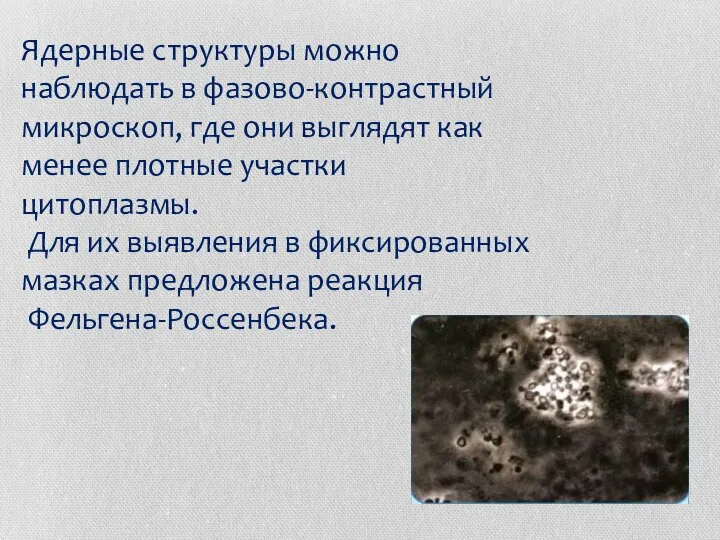 Ядерные структуры можно наблюдать в фазово-контрастный микроскоп, где они выглядят как менее