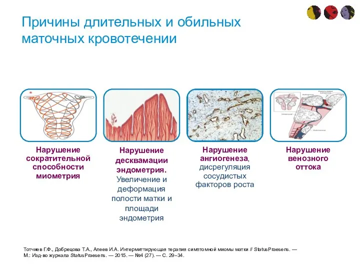 Причины длительных и обильных маточных кровотечении Тотчиев Г.Ф., Добрецова Т.А., Алеев И.А.