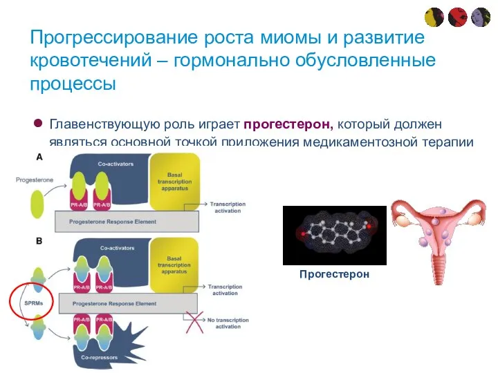 Прогрессирование роста миомы и развитие кровотечений – гормонально обусловленные процессы Главенствующую роль