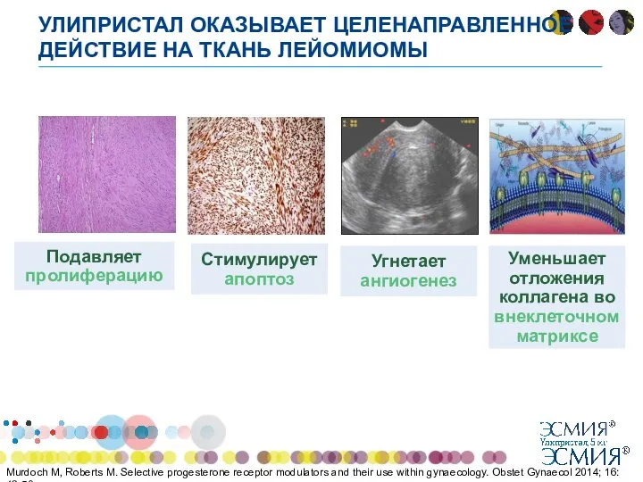 УЛИПРИСТАЛ ОКАЗЫВАЕТ ЦЕЛЕНАПРАВЛЕННОЕ ДЕЙСТВИЕ НА ТКАНЬ ЛЕЙОМИОМЫ Murdoch M, Roberts M. Selective