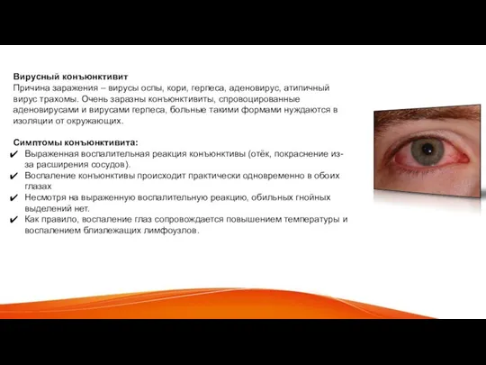 Вирусный конъюнктивит Причина заражения – вирусы оспы, кори, герпеса, аденовирус, атипичный вирус