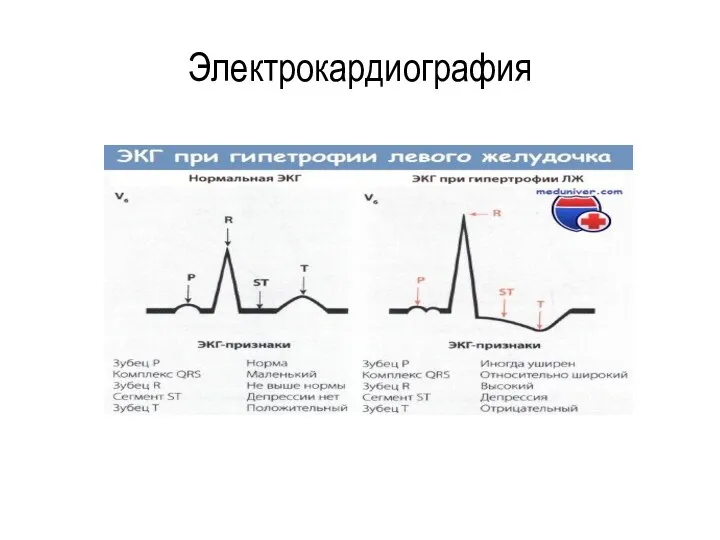 Электрокардиография