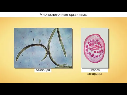 Аскарида Разрез аскариды Многоклеточные организмы