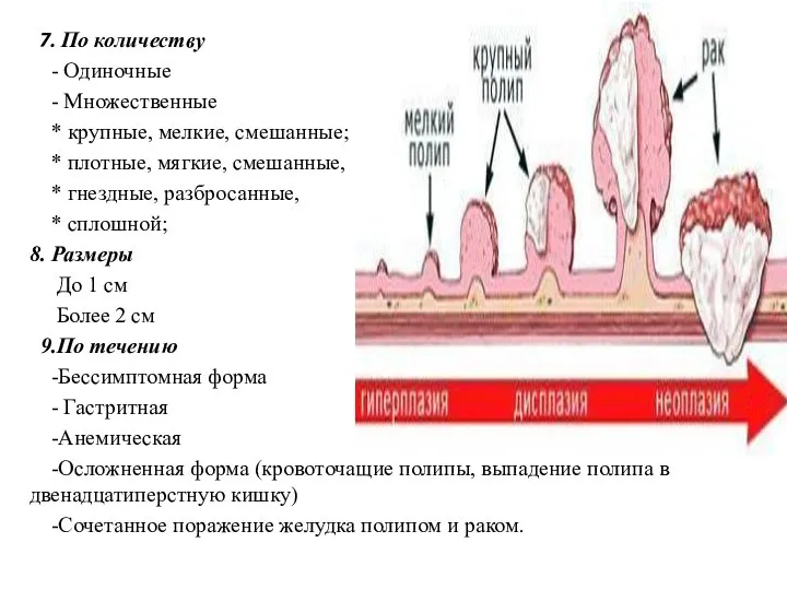 7. По количеству - Одиночные - Множественные * крупные, мелкие, смешанные; *