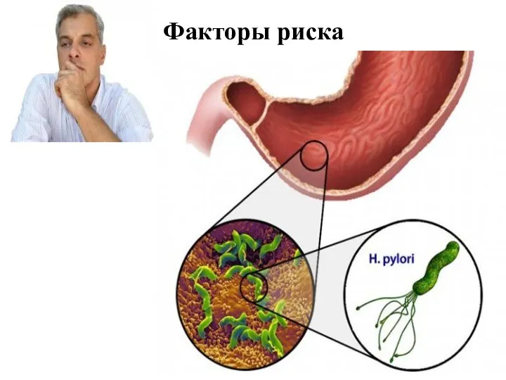 Факторы риска