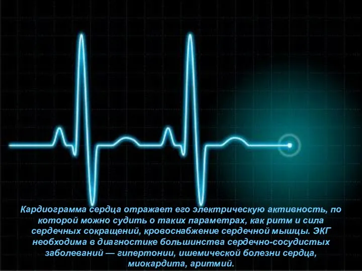 Кардиограмма сердца отражает его электрическую активность, по которой можно судить о таких