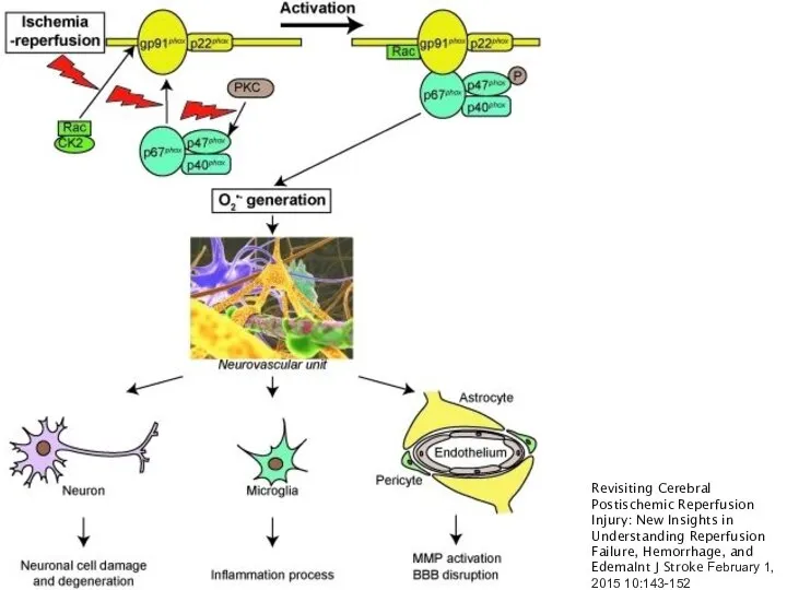 Revisiting Cerebral Postischemic Reperfusion Injury: New Insights in Understanding Reperfusion Failure, Hemorrhage,