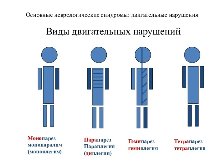 Основные неврологические синдромы: двигательные нарушения Виды двигательных нарушений Монопарез монопаралич (моноплегия) Парапарез