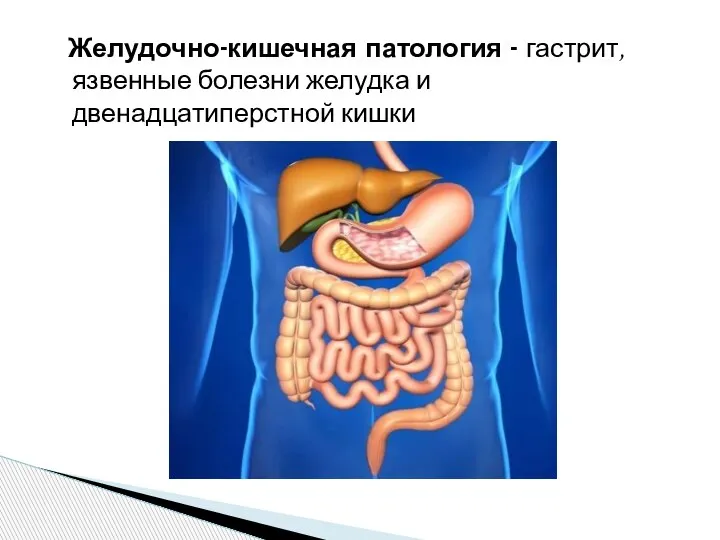 Желудочно-кишечная патология - гастрит, язвенные болезни желудка и двенадцатиперстной кишки