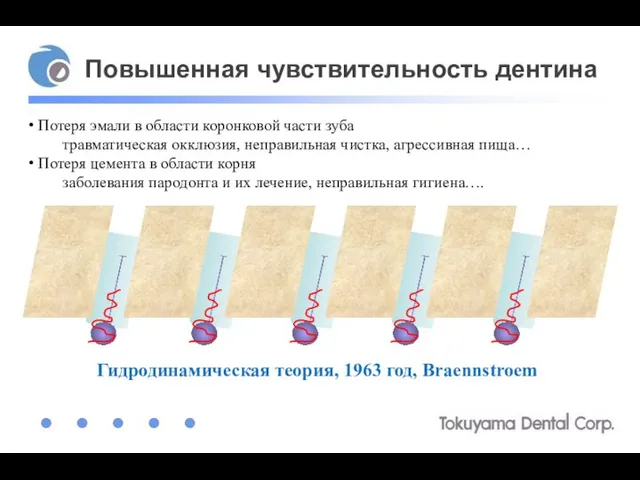 Повышенная чувствительность дентина Потеря эмали в области коронковой части зуба травматическая окклюзия,