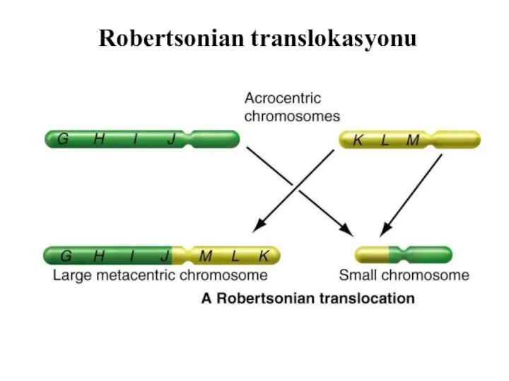 Robertsonian translokasyonu