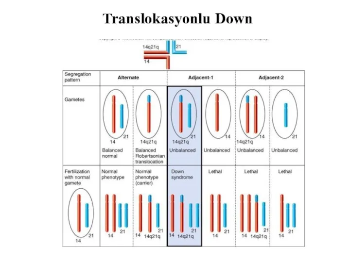 Translokasyonlu Down