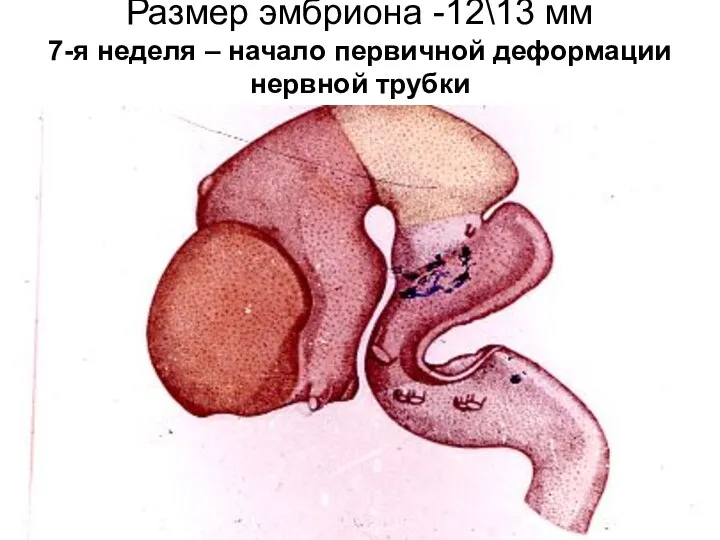 Размер эмбриона -12\13 мм 7-я неделя – начало первичной деформации нервной трубки