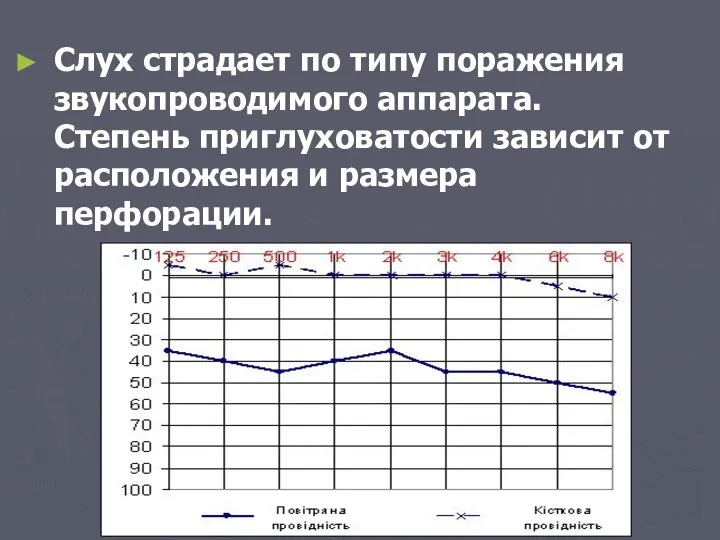 Слух страдает по типу поражения звукопроводимого аппарата. Степень приглуховатости зависит от расположения и размера перфорации.