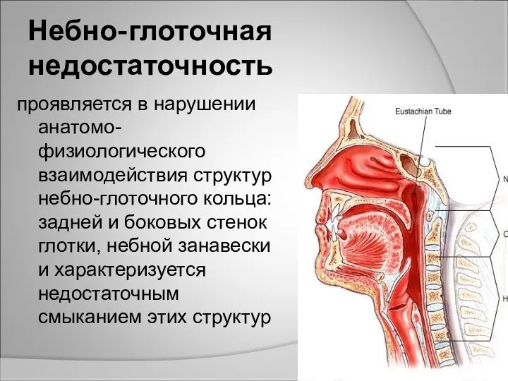 Небно-глоточная недостаточность проявляется в нарушении анатомо-физиологического взаимодействия структур небно-глоточного кольца: задней и