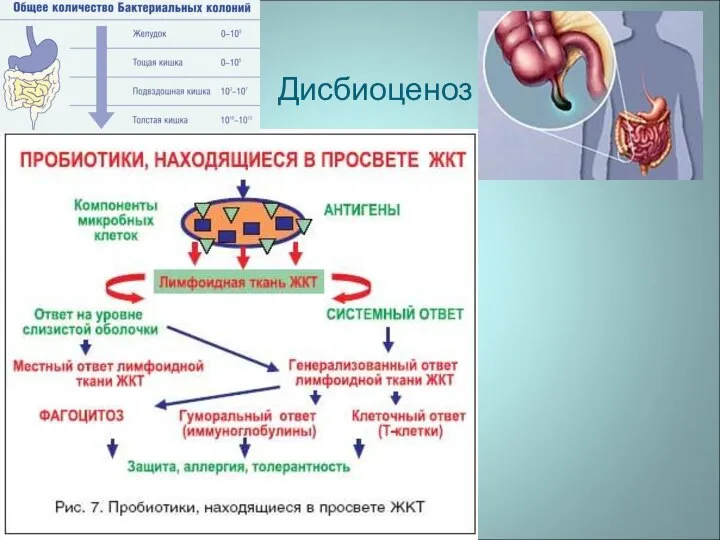 Дисбиоценоз