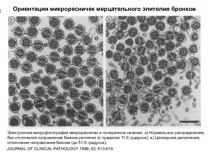 Электронная микрофотография микроресничек в поперечном сечении. а) Нормальное распределение, без отклонения направления