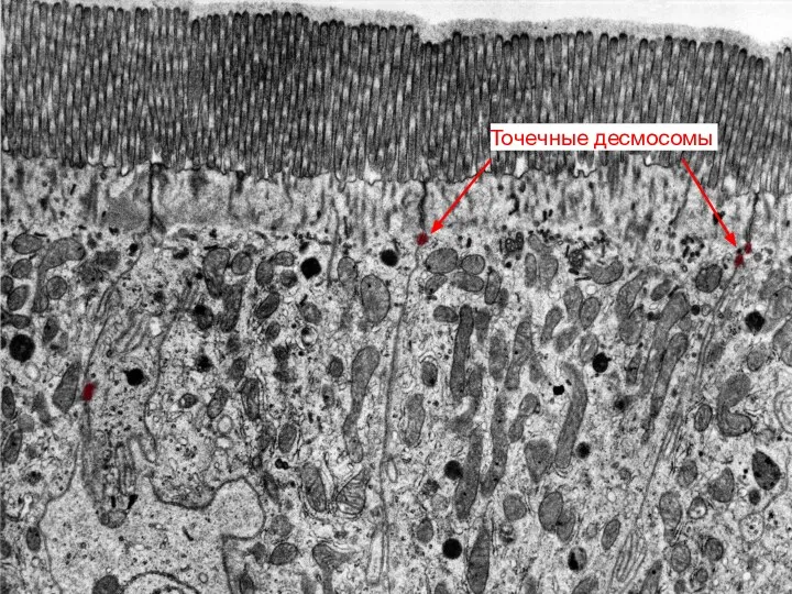 Точечные десмосомы
